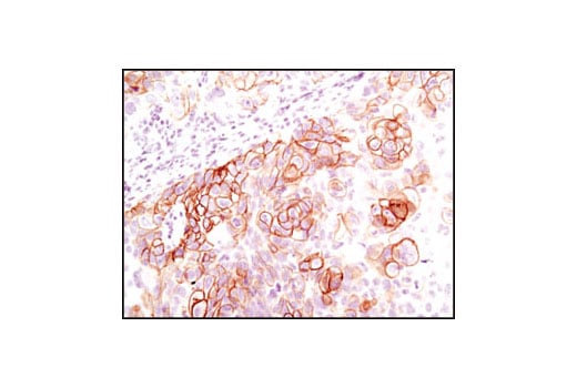 Immunohistochemistry Image 4: Phospho-Met (Tyr1234/1235) (D26) Rabbit Monoclonal Antibody (BSA and Azide Free)