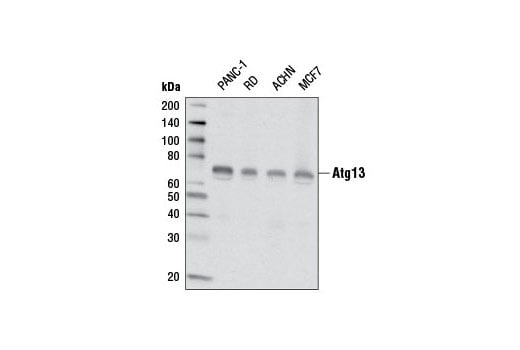 Western Blotting Image 1: Atg13 (E1Y9V) Rabbit mAb (BSA and Azide Free)