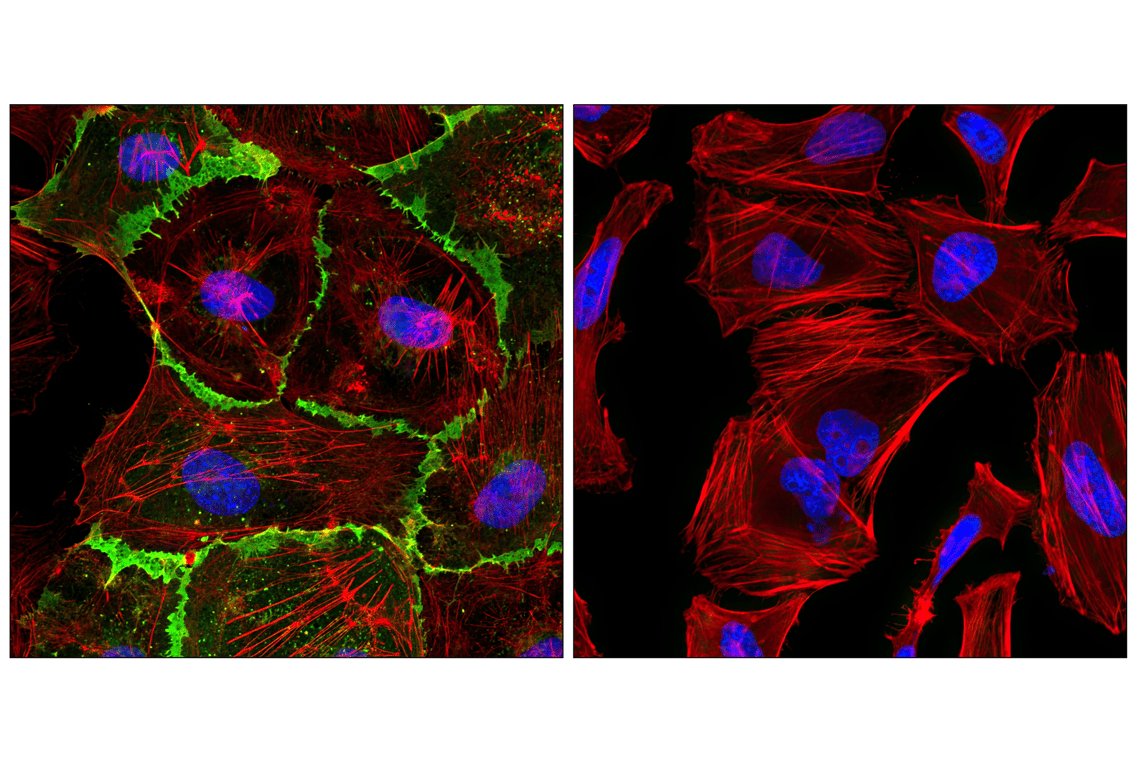 Immunofluorescence Image 1: CD31 (PECAM-1) (89C2) Mouse Monoclonal Antibody