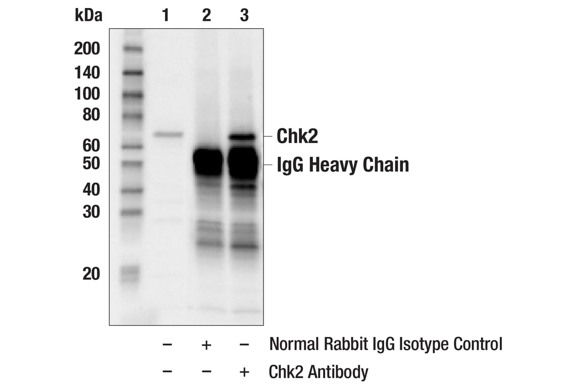 Immunoprecipitation Image 1: Chk2 Antibody