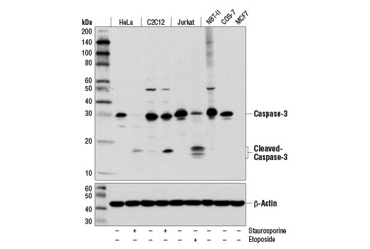 Western Blotting Image 1: Caspase-3 (D3R6Y) Rabbit mAb