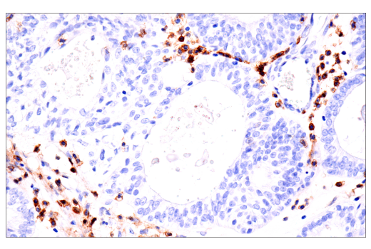 Immunohistochemistry Image 4: CD4 (EP204) Rabbit Monoclonal Antibody
