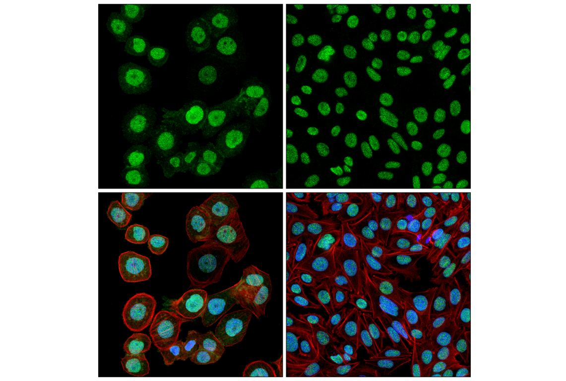 Immunofluorescence Image 1: Tyk2 (D4I5T) Rabbit Monoclonal Antibody