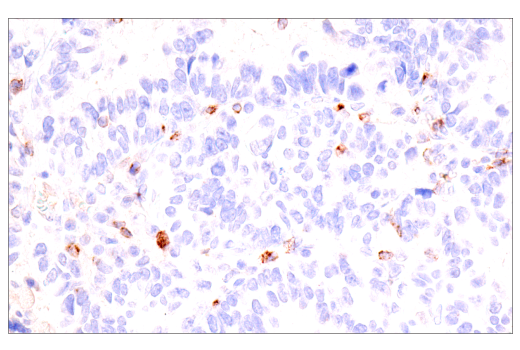 Immunohistochemistry Image 8: CTLA-4 (E2V1Z) Rabbit Monoclonal Antibody (BSA and Azide Free)
