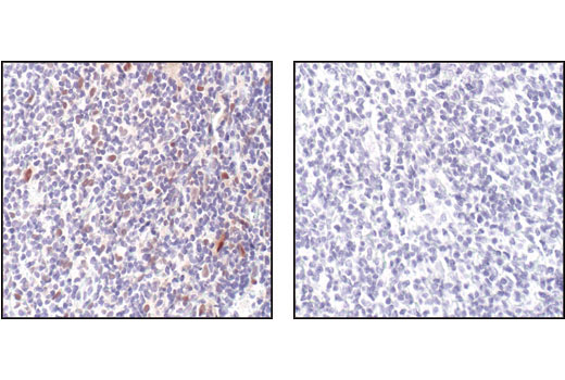 Immunohistochemistry Image 1: Phospho-Stat1 (Tyr701) (58D6) Rabbit Monoclonal Antibody (BSA and Azide Free)