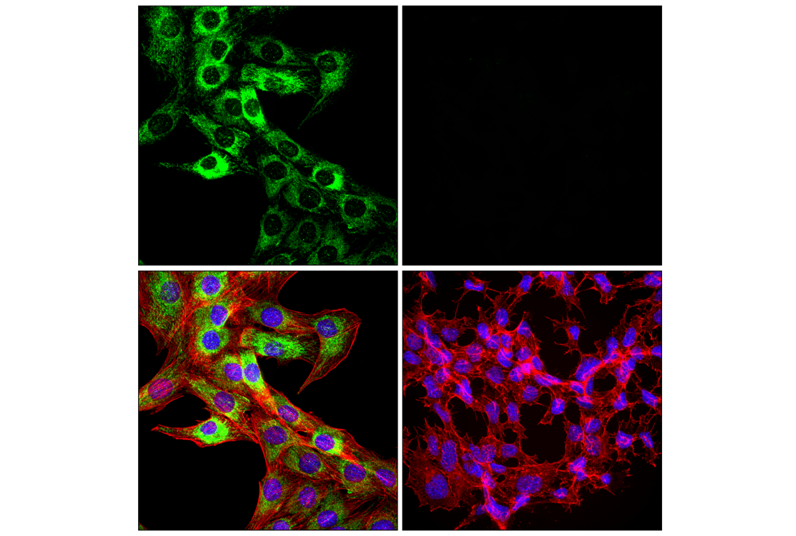 Immunofluorescence Image 1: TSPO (F5B8F) Rabbit Monoclonal Antibody