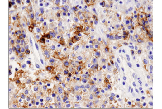 Immunohistochemistry Image 3: PD-L2 (D7U8C) Rabbit Monoclonal Antibody
