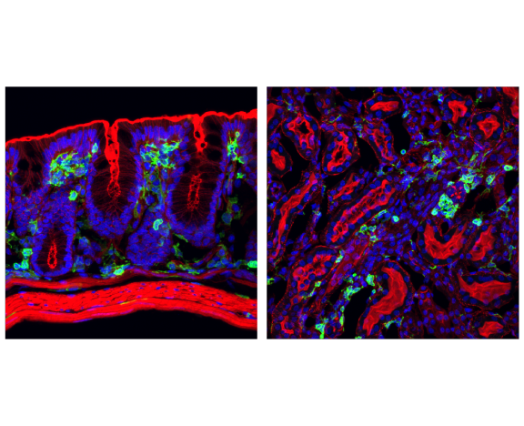Immunofluorescence Image 3: CD45 (D3F8Q) Rabbit Monoclonal Antibody (BSA and Azide Free)