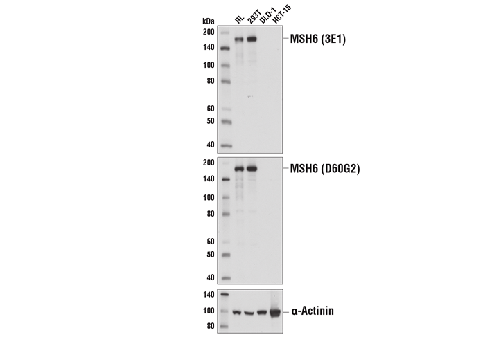 Western Blotting Image 2: MSH6 (3E1) Mouse Monoclonal Antibody