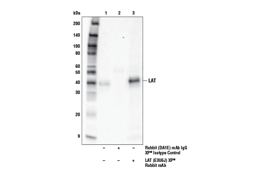 Immunoprecipitation Image 1: LAT (E3U6J) Rabbit Monoclonal Antibody