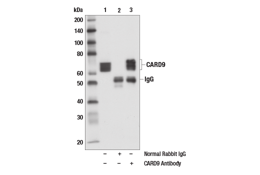 Immunoprecipitation Image 1: CARD9 Antibody