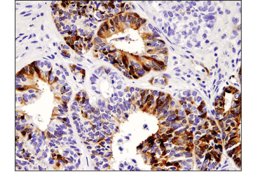 IDO (D5J4E) Rabbit mAb (#86630) Datasheet With Images | Cell
