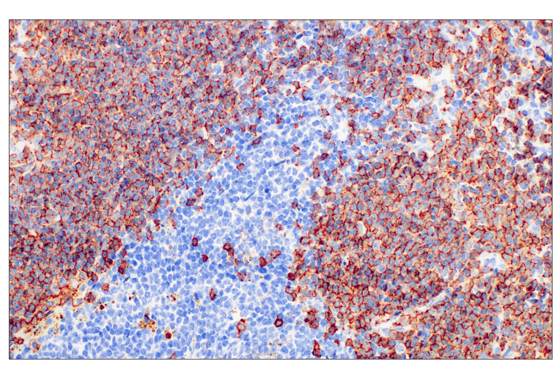 Immunohistochemistry Image 1: CD20 (E3N7O) Rabbit Monoclonal Antibody