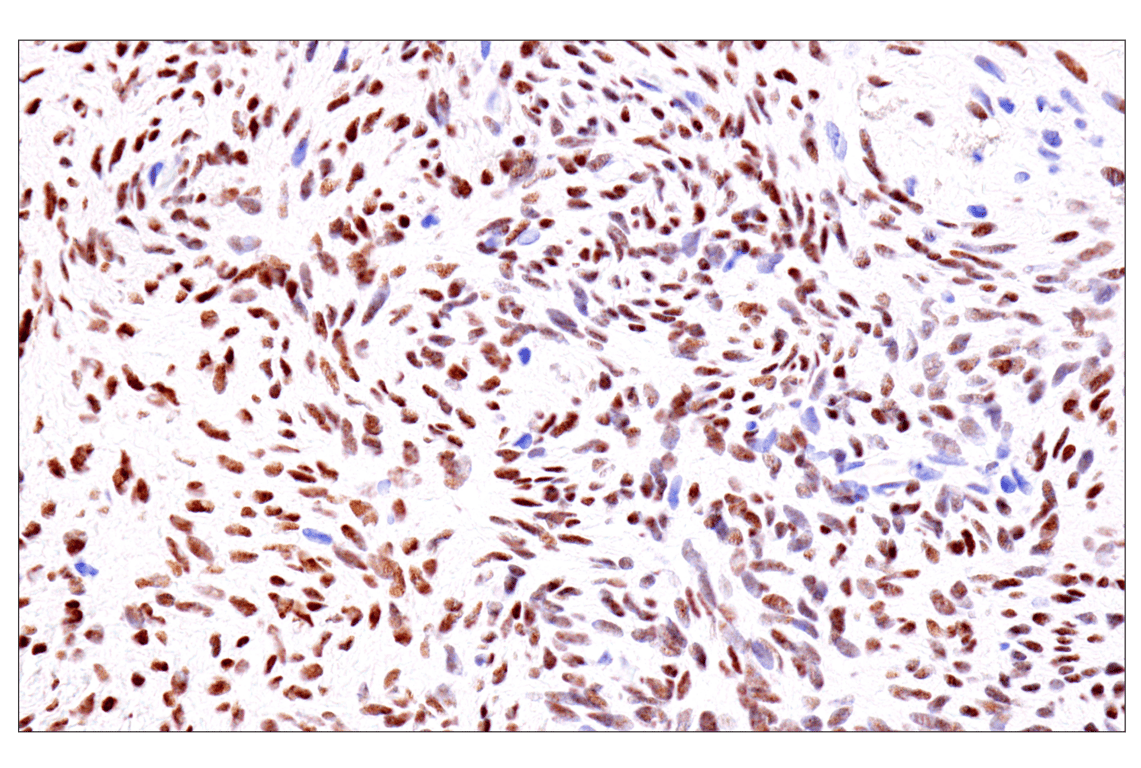 Immunohistochemistry Image 11: GATA-6 (D61E4) XP<sup>®</sup> Rabbit mAb (BSA and Azide Free)