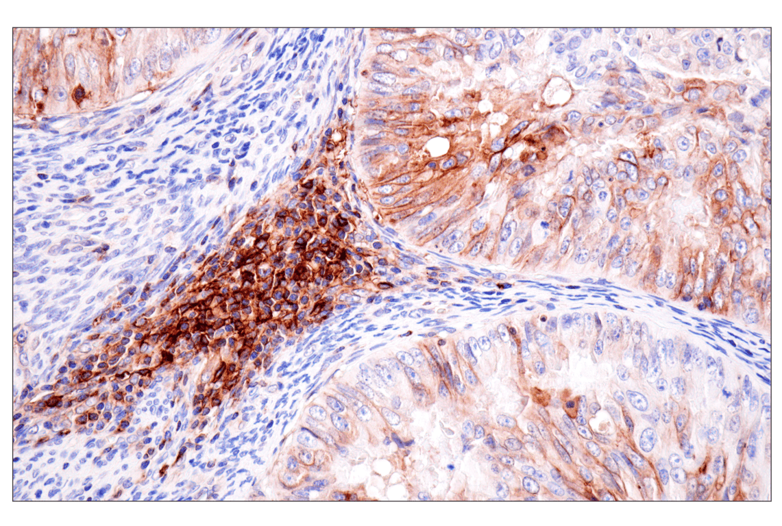 Immunohistochemistry Image 2: HLA-B (BC43) Mouse Monoclonal Antibody
