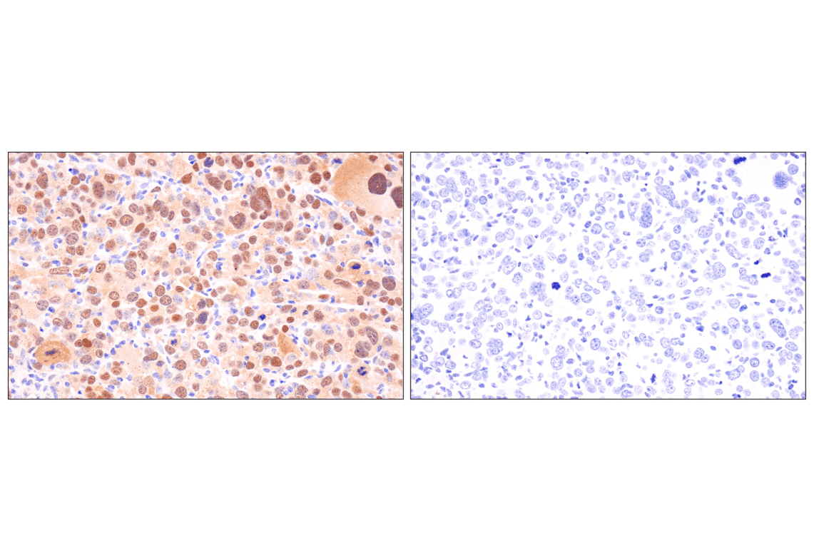 Immunohistochemistry Image 4: p19 ARF (F6F7N) Rabbit Monoclonal Antibody