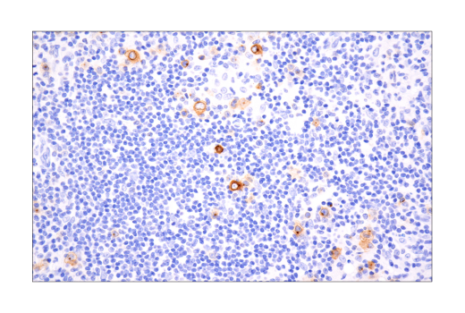 Immunohistochemistry Image 1: TNFRSF8/CD30 (E7E4D) Rabbit Monoclonal Antibody (BSA and Azide Free)