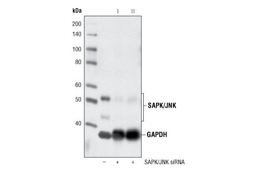 undefined Image 1: SignalSilence<sup>®</sup> SAPK/JNK siRNA I