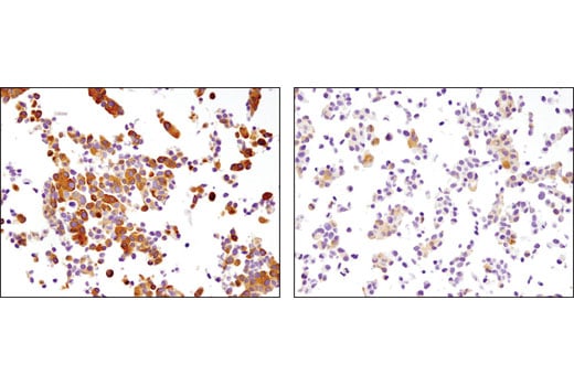 Immunohistochemistry Image 2: Phospho-PRAS40 (Thr246) (D4D2) Rabbit Monoclonal Antibody (BSA and Azide Free)