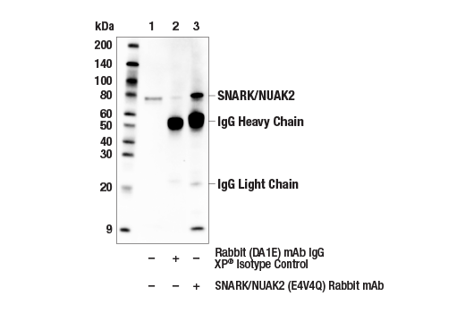 Immunoprecipitation Image 1: SNARK/NUAK2 (E4V4Q) Rabbit Monoclonal Antibody