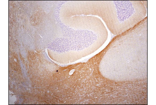 undefined Image 45: Pathological Hallmarks of Alzheimer's Disease Antibody Sampler Kit