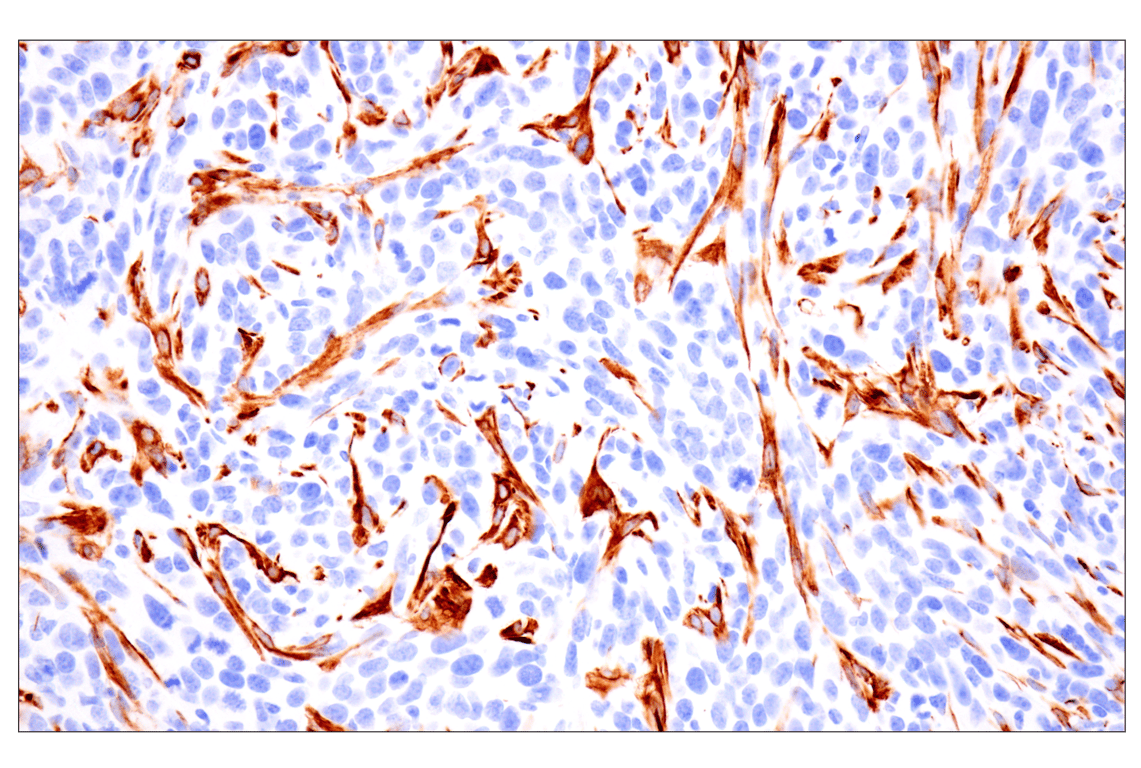 Immunohistochemistry Image 12: Desmin (F5V4I) Rabbit Monoclonal Antibody (BSA and Azide Free)