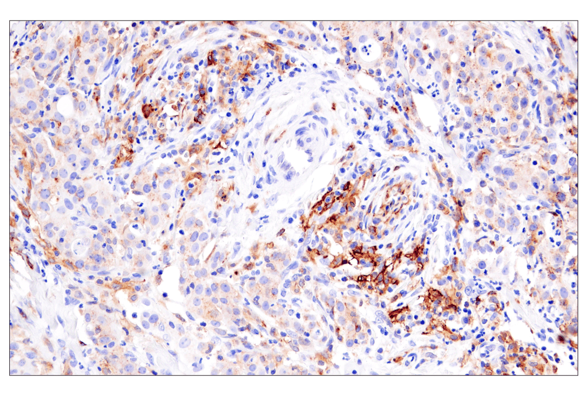 Immunohistochemistry Image 4: HLA-DRA (E9R2Q) Rabbit Monoclonal Antibody
