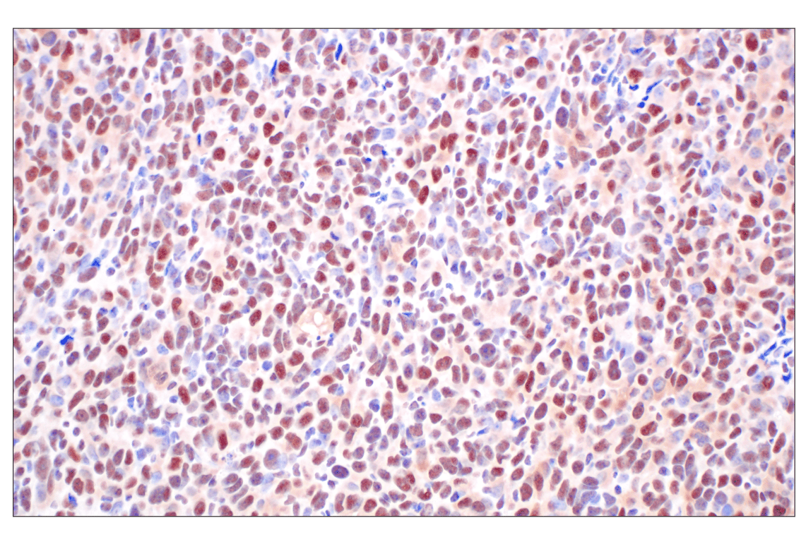 Immunohistochemistry Image 6: FKBP5 (F1G3I) Rabbit Monoclonal Antibody