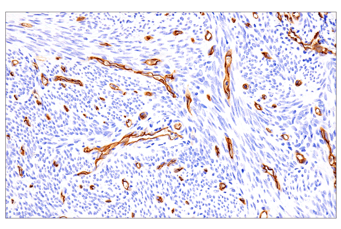 Immunohistochemistry Image 9: EMCN (E3Z4D) Rabbit mAb