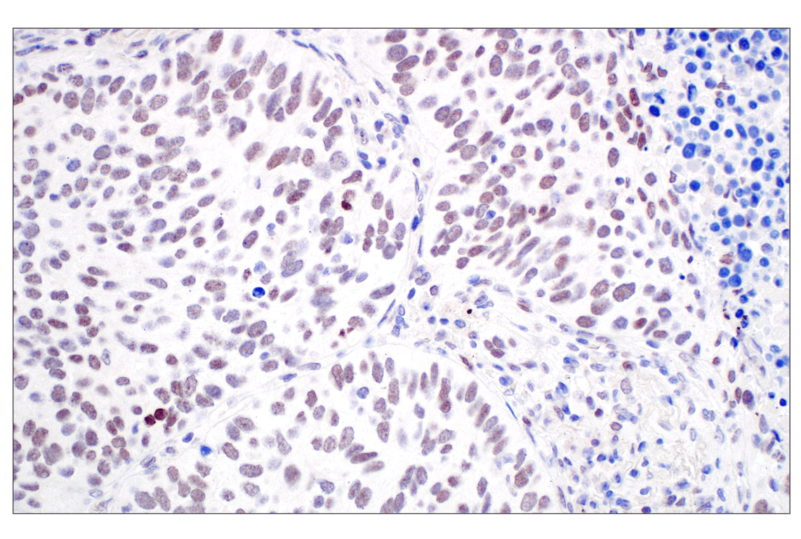 Immunohistochemistry Image 2: MDM2 (F7W7X) Rabbit Monoclonal Antibody