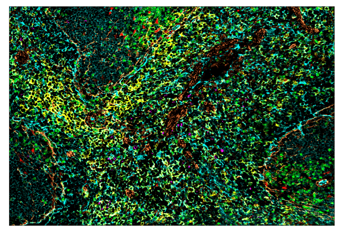 Immunohistochemistry Image 1: CD31 (PECAM-1) (D8V9E) & CO-0050-647 SignalStar<sup>™</sup> Oligo-Antibody Pair