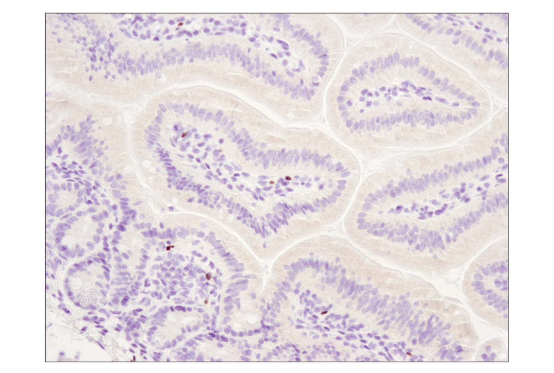 Immunohistochemistry Image 3: FoxP3 (D6O8R) Rabbit Monoclonal Antibody