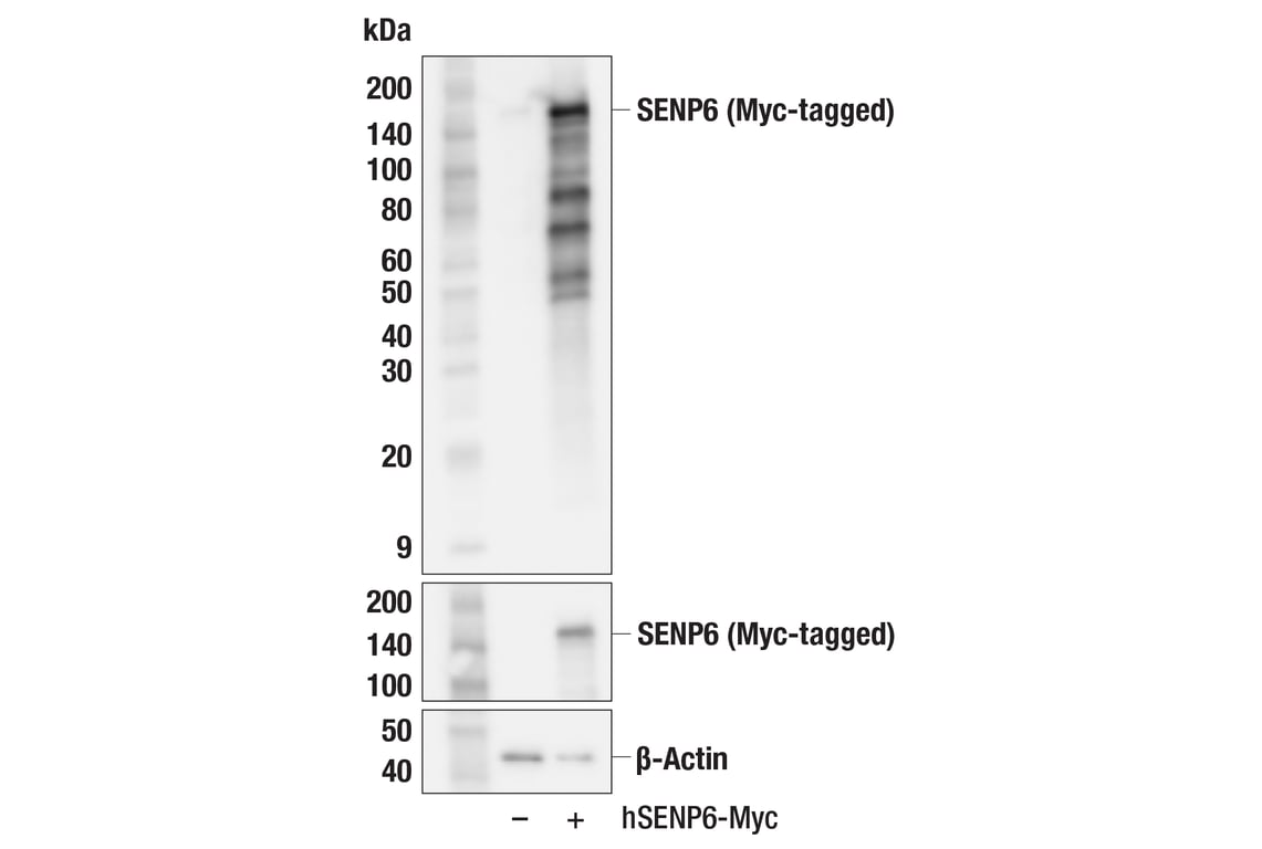 Western Blotting Image 2: SENP6 (F2K4K) Rabbit Monoclonal Antibody