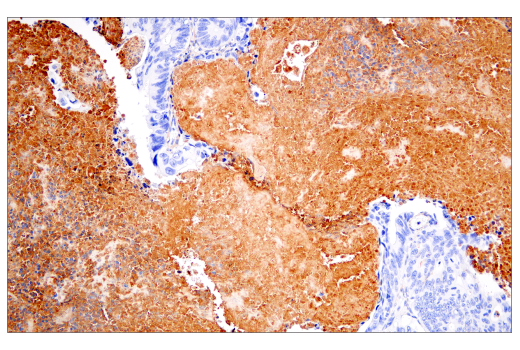 Immunohistochemistry Image 3: Fibronectin/FN1 (E5H6X) Rabbit Monoclonal Antibody (BSA and Azide Free)