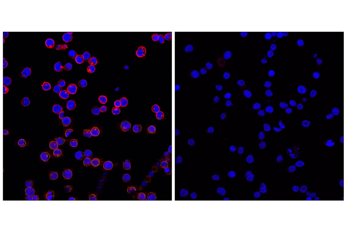 Immunofluorescence Image 1: CD45 (Intracellular Domain) (D9M8I) Rabbit Monoclonal Antibody (Alexa Fluor<sup>®</sup> 555 Conjugate)