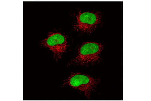 Immunofluorescence Image 1: Ubiquityl-Histone H2A (Lys119) (D27C4) Rabbit Monoclonal Antibody (BSA and Azide Free)