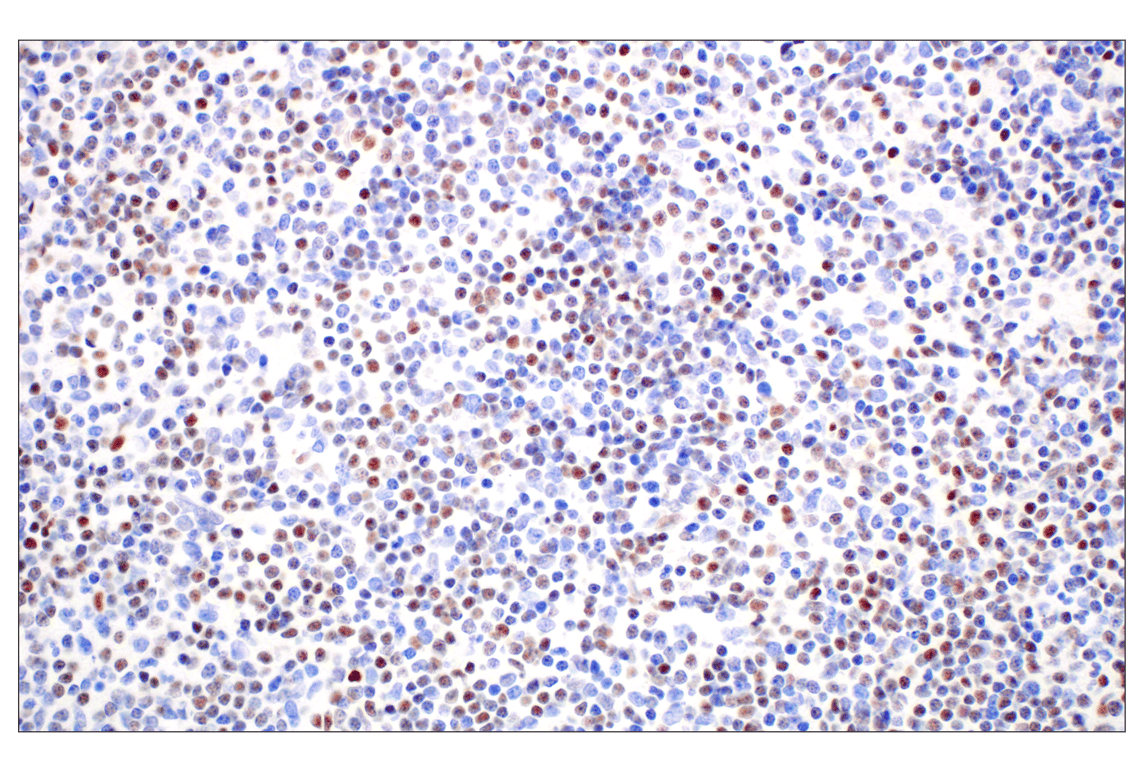 Immunohistochemistry Image 1: KLF2 (E7K8Y) Rabbit Monoclonal Antibody
