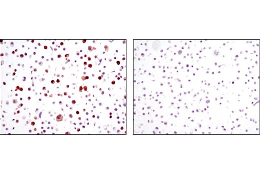 Immunohistochemistry Image 4: Thymidylate Synthase (D5B3) Rabbit Monoclonal Antibody