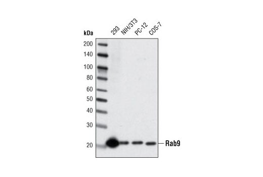 Western Blotting Image 1: Rab9 (D22A6) Rabbit mAb