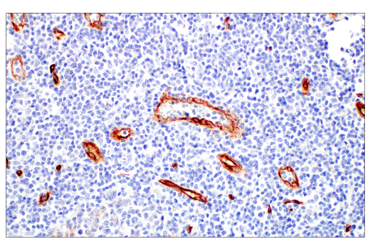 Immunohistochemistry Image 11: Nestin (E4O9E) XP<sup>®</sup> Rabbit mAb