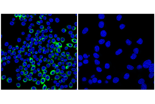 Immunofluorescence Image 1: Osteopontin/SPP1 (E9Z1D) Rabbit Monoclonal Antibody (BSA and Azide Free)