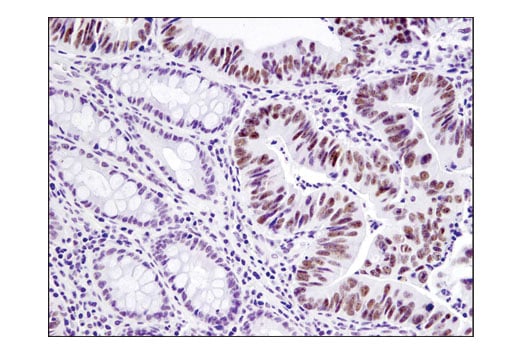 Immunohistochemistry Image 2: UTX (D3Q1I) Rabbit Monoclonal Antibody