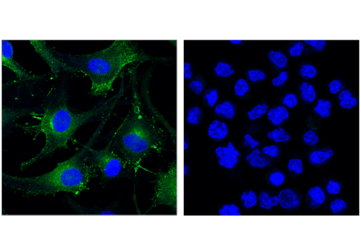 Immunofluorescence Image 1: Rab27A (D7Z9Q) Rabbit Monoclonal Antibody (BSA and Azide Free)