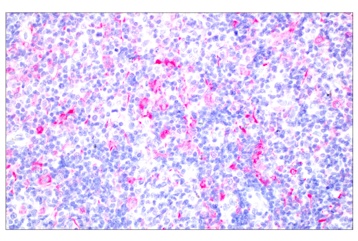Immunohistochemistry Image 3: SignalStain<sup>®</sup> Boost IHC Detection Reagent (AP, Rat)