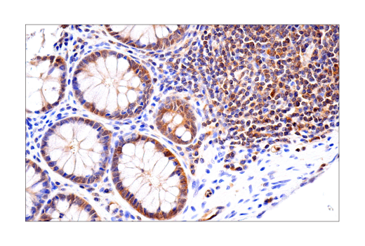 Immunohistochemistry Image 4: RIP3 (E7A7F) Rabbit Monoclonal Antibody