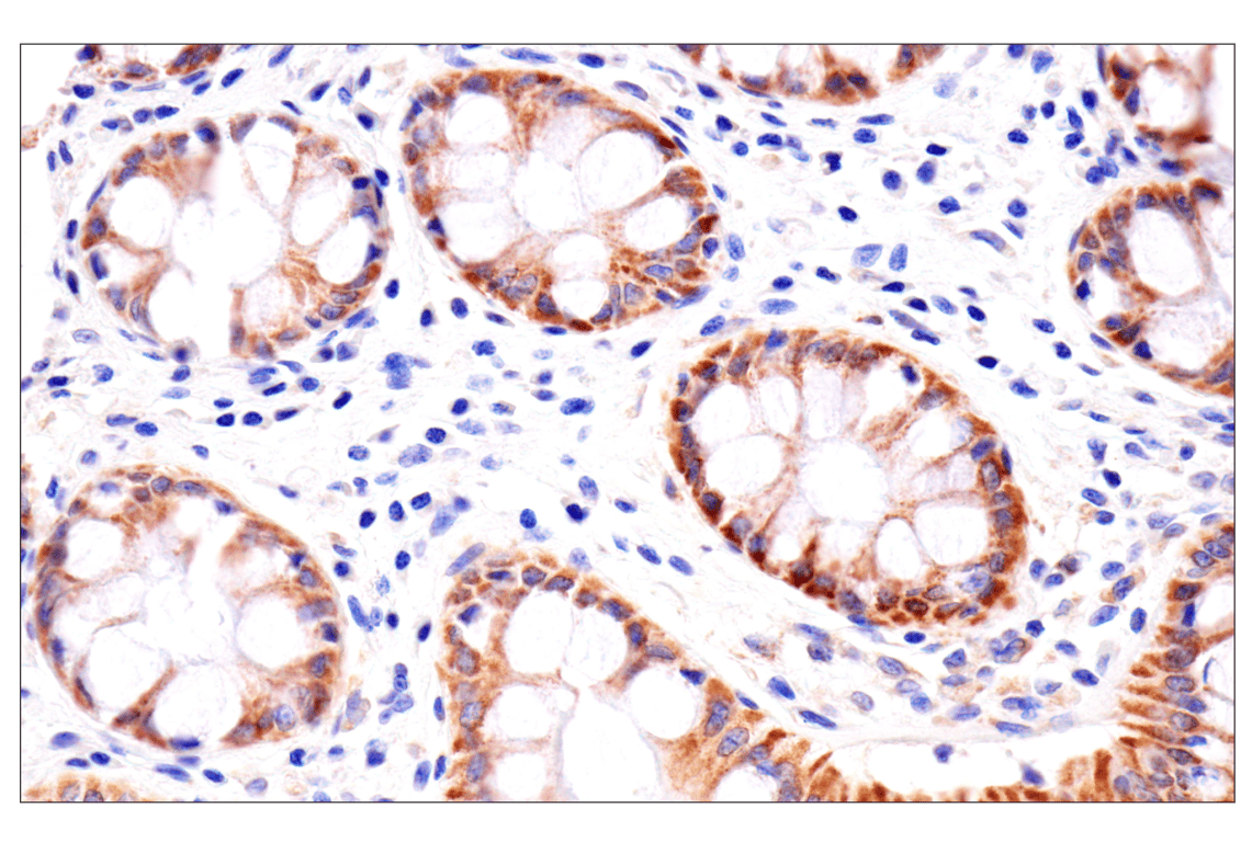 Immunohistochemistry Image 9: AMACR (F7T6V) Rabbit Monoclonal Antibody