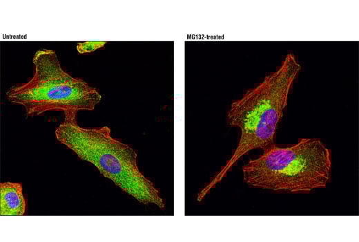Immunofluorescence Image 1: HDAC6 (D2E5) Rabbit Monoclonal Antibody