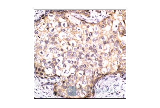 Immunohistochemistry Image 1: beta-Catenin Antibody
