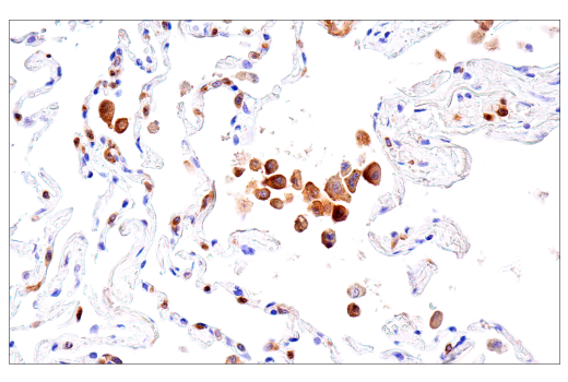 Immunohistochemistry Image 8: DAP12 (E8P9U) Rabbit Monoclonal Antibody (BSA and Azide Free)