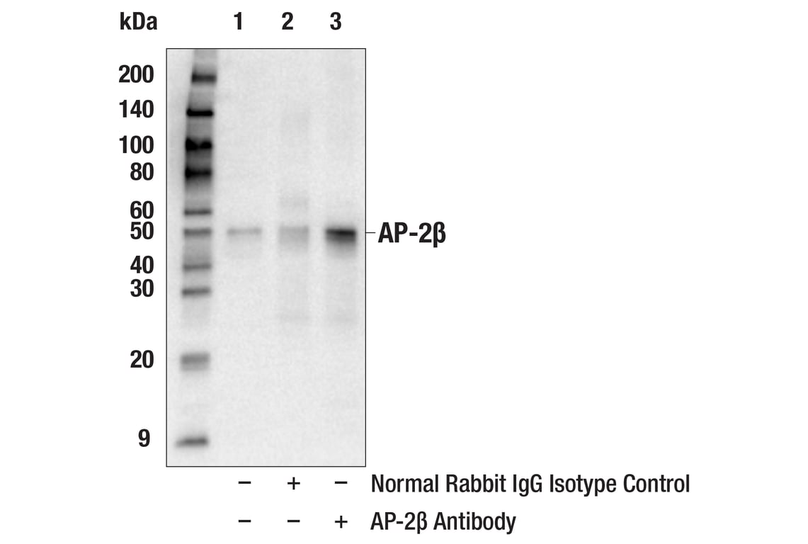 Immunoprecipitation Image 1: AP-2 beta Antibody